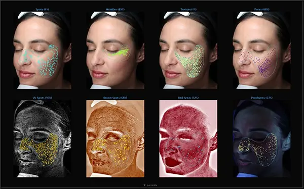Catalog Tratamente Cosmetice Faciale 4