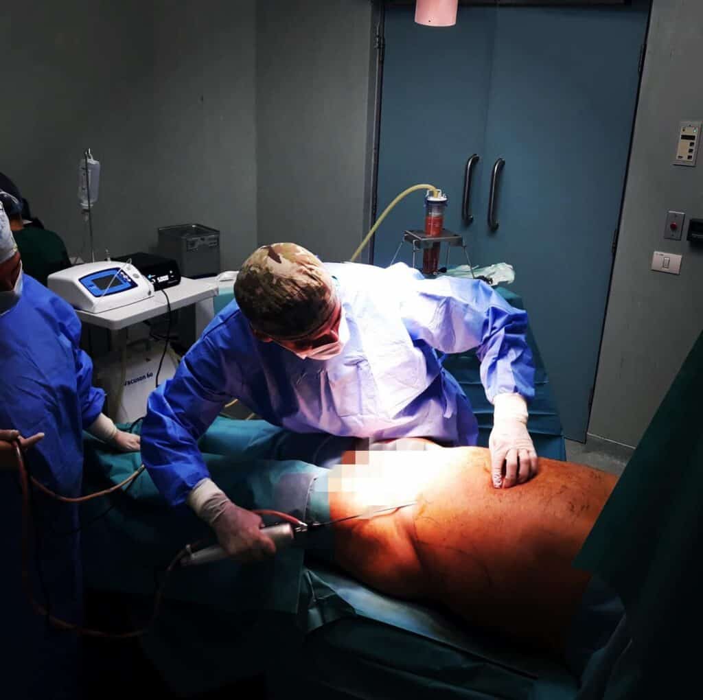 Dr Adrian Pelinaru in timpul opratiei de liposuctie asistata cu Vibrasat Pro